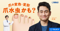 テレシー、佐藤製薬の爪水虫の疾患啓発を目的としたテレビCMの制作・放映を担当